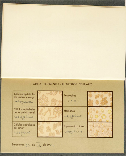 Documentos clínicos Clínica Barraquer, Barcelona, 1954