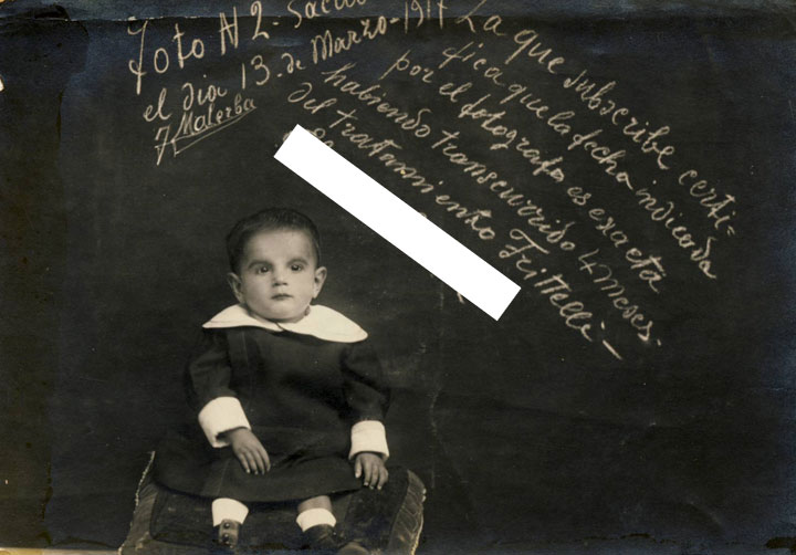 Fotografías de dos casos clínicos (1916 y 1917) de dos niños tratados con el tratamiento Frittelli