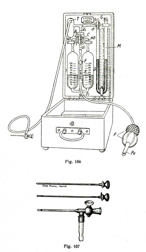 Aparato de neumot&oacute;rax artificial
